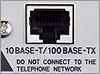 10Base-T/100Base-TX Interface